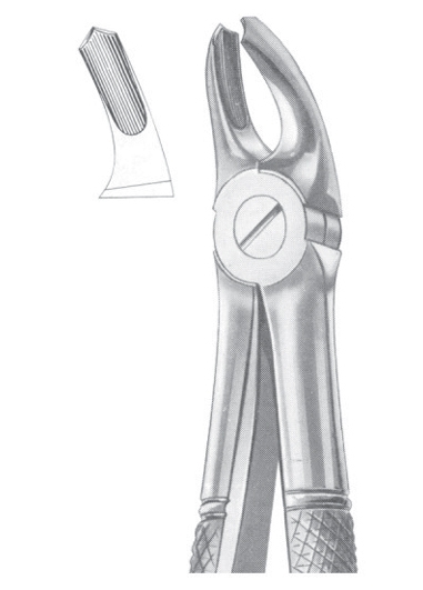 Fig. 39A upper molars for children 